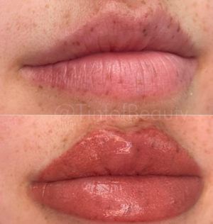 freckle lip blush in atlanta, ga